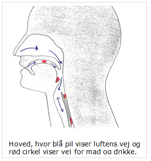 synkebesvær 3.PNG