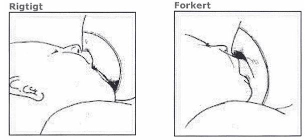 Suttebrik - rigtigt og forkert.JPG